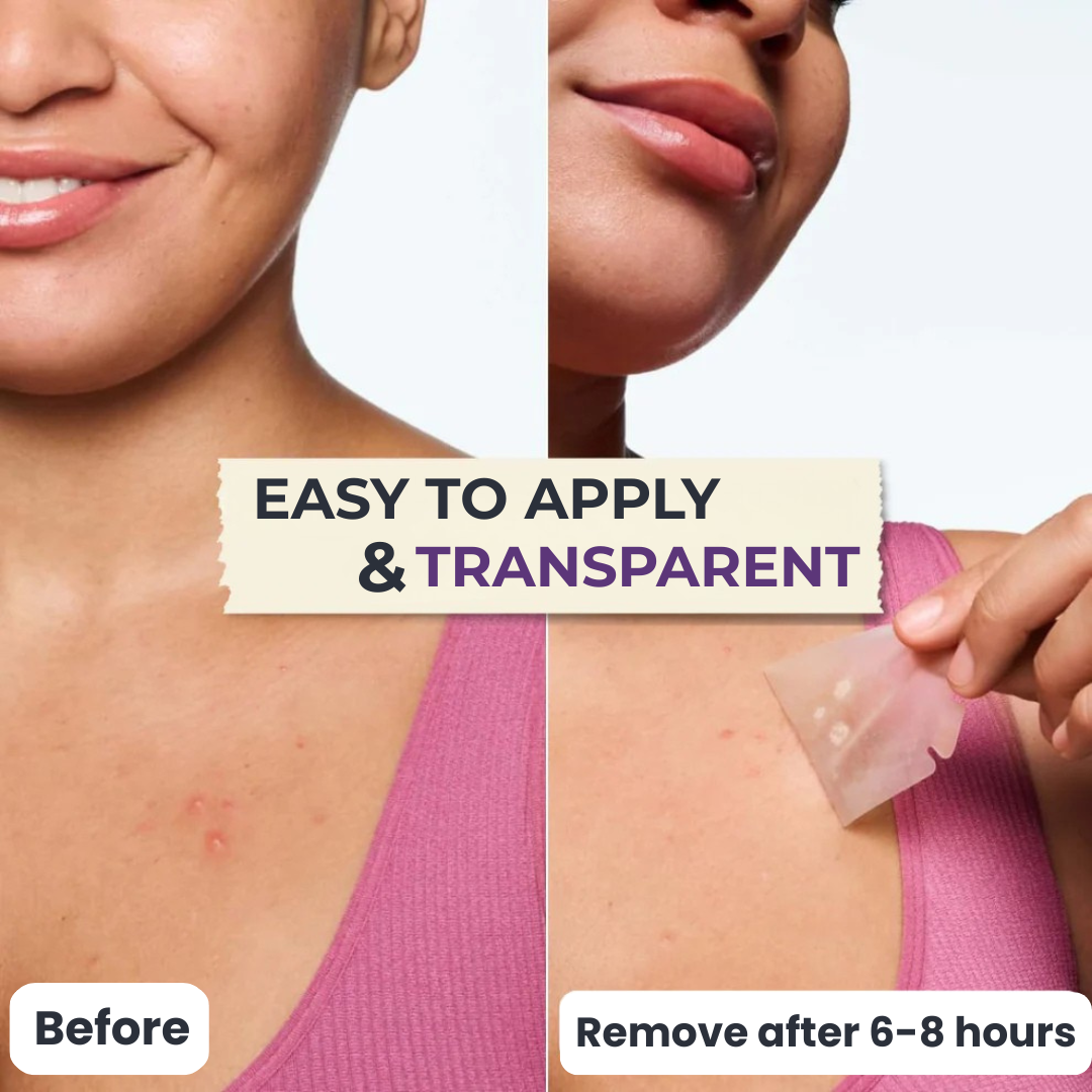 Tamoora™ ClearSkin Patches